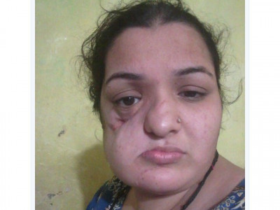 india grants medical visa to pakistani cancer patient india grants medical visa to pakistani cancer patient