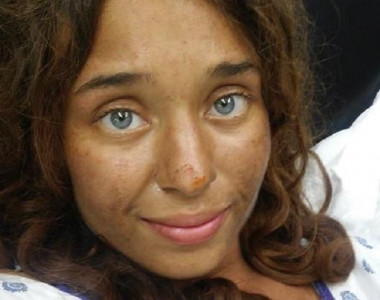 missing woman survives month in forest living off berries and mushrooms