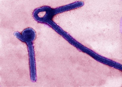 alarm bells as first congo fever patient emerges alarm bells as first congo fever patient emerges
