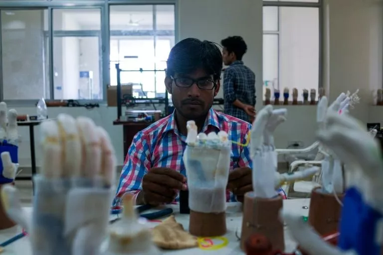 in this photograph taken on june 13 2017 a technician adds a battery to prosthetic hands at the bhagwan mahaveer viklang sahayata samiti non profit organisation 039 s main branch in jaipur photo afp in this photograph taken on june 13 2017 a technician adds a battery to prosthetic hands at the bhagwan mahaveer viklang sahayata samiti non profit organisation 039 s main branch in jaipur photo afp