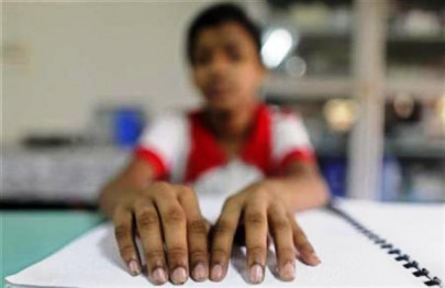 i am blind not disgusting