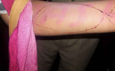 indian teenager attempting blue whale challenge rescued indian teenager attempting blue whale challenge rescued