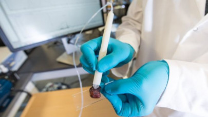 pen identifies cancer in just 10 seconds pen identifies cancer in just 10 seconds