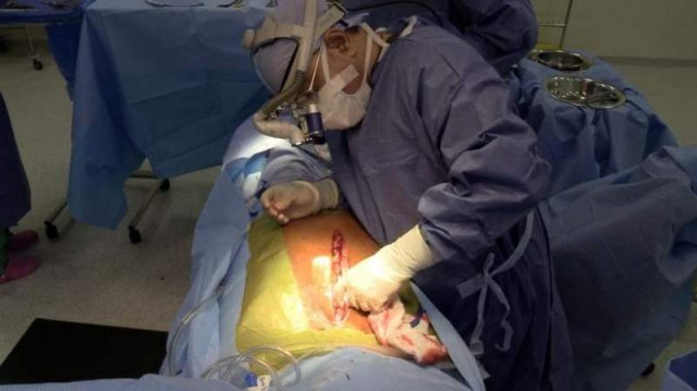 fakharul islam was operated upon for an aortic root replacement surgery while his heart was still beating photo courtesy khaleej times fakharul islam was operated upon for an aortic root replacement surgery while his heart was still beating photo courtesy khaleej times