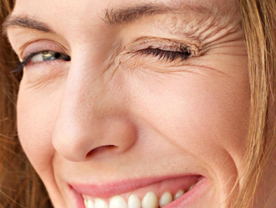 9 surprising causes of wrinkles 9 surprising causes of wrinkles