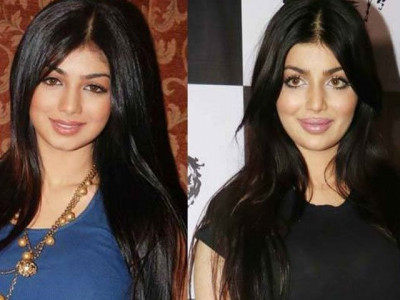 it is a personal choice ayesha takia on plastic surgery it is a personal choice ayesha takia on plastic surgery