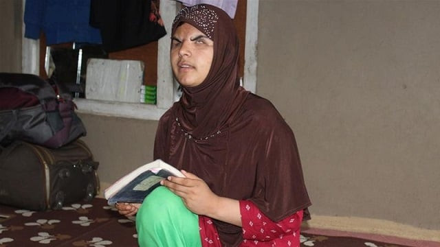 doctors described insha mushtaq 039 s case as the worst they had ever seen photo al jazeera doctors described insha mushtaq 039 s case as the worst they had ever seen photo al jazeera