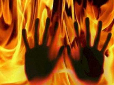 man sets wife on fire in sialkot
