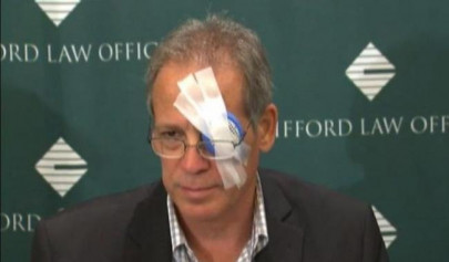 chicago man blinded in one eye by baseball sues the sport chicago man blinded in one eye by baseball sues the sport