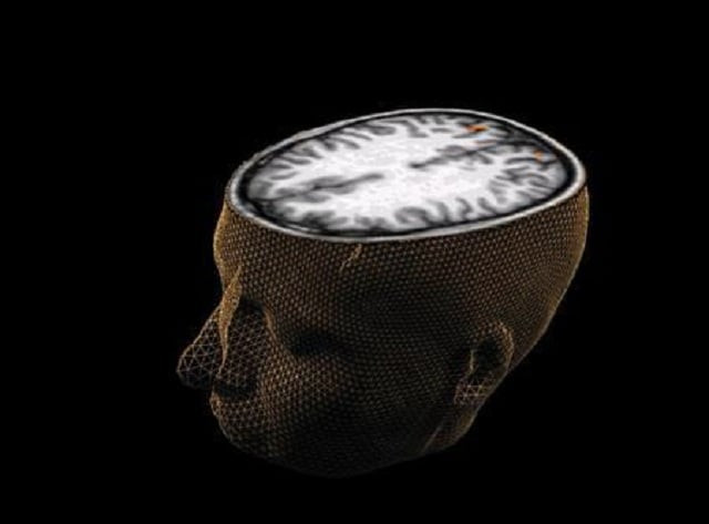 a cure for dyslexia may exist photo reuters a cure for dyslexia may exist photo reuters