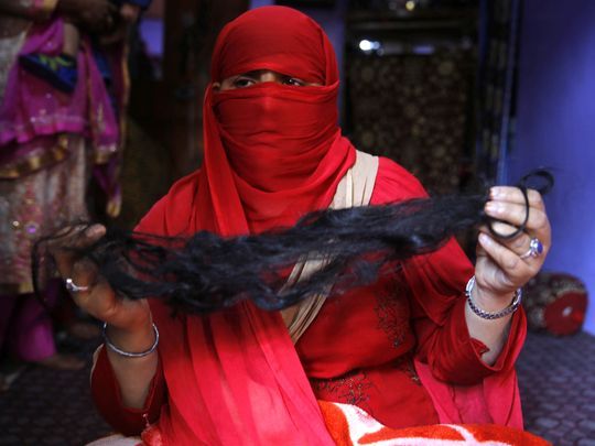 tasleema a kashmiri woman shows her hair after an alleged braid chopping attack in the natipora area of srinagar photo farooq khan