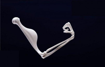 8 of pakistanis over 60 vulnerable to osteoporosis 8 of pakistanis over 60 vulnerable to osteoporosis