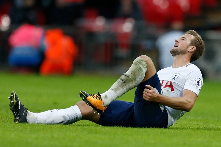 tottenham hotspur 039 s english striker harry kane holds his leg after appearing to pick up an injury during the english premier league football match between tottenham hotspur and liverpool at wembley stadium in london on october 22 2017 photo afp