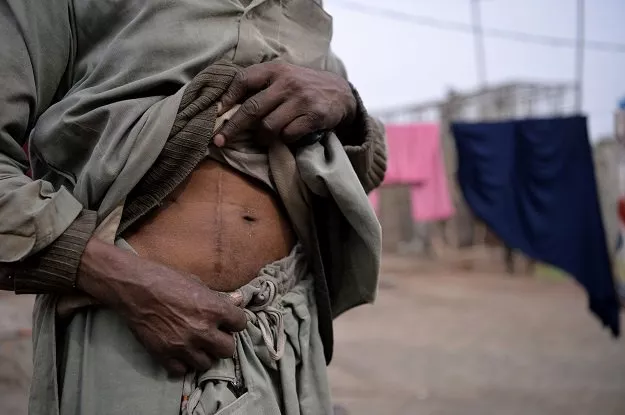 a victim of the kidney trade photo afp file a victim of the kidney trade photo afp file