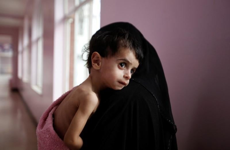 a woman holds her malnourished boy after he was weighed at a hospital malnutrition intensive care unit in sanaa yemen september 27 2016 photo reuters