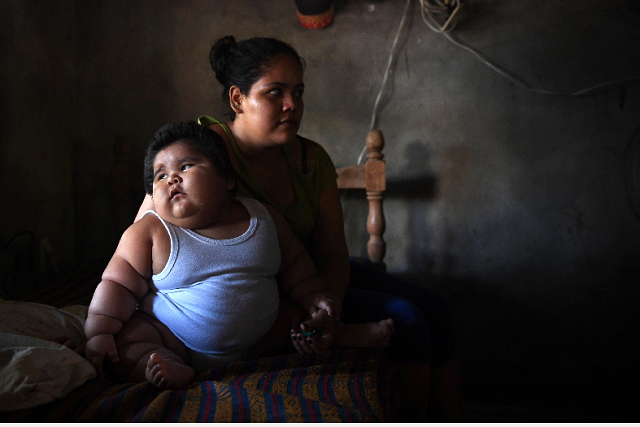 ten month old luis gonzales l and his mother isabel pantoja 24 are pictured at their home in tecoman colima state mexico luis manuel gonzales is almost like any ten month old baby he babbles his first words and wants to touch everything but he has a dramatic difference that puts his life at stake he weighs 28 kilos photo afp