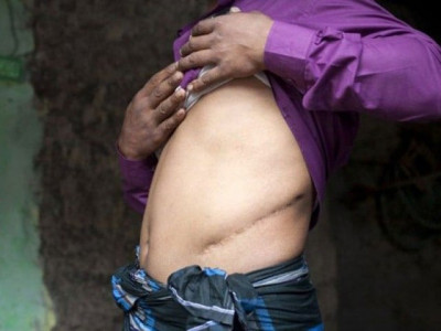 suspects in k p face punishment beyond kidney theft