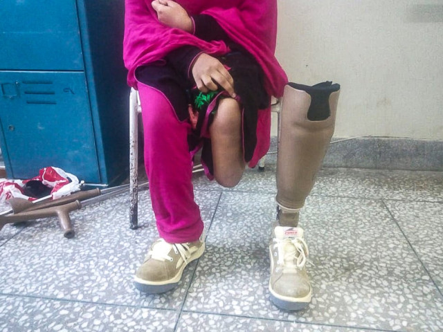 a female victim of a landmine blast photo express a female victim of a landmine blast photo express