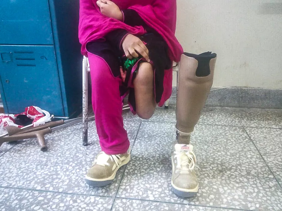 a female victim of a landmine blast photo express a female victim of a landmine blast photo express