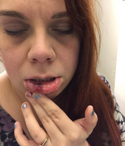 sam saia 37 was hit in the face by a man she called out for 039 manspreading 039 photo courtesy mailonline sam saia 37 was hit in the face by a man she called out for 039 manspreading 039 photo courtesy mailonline