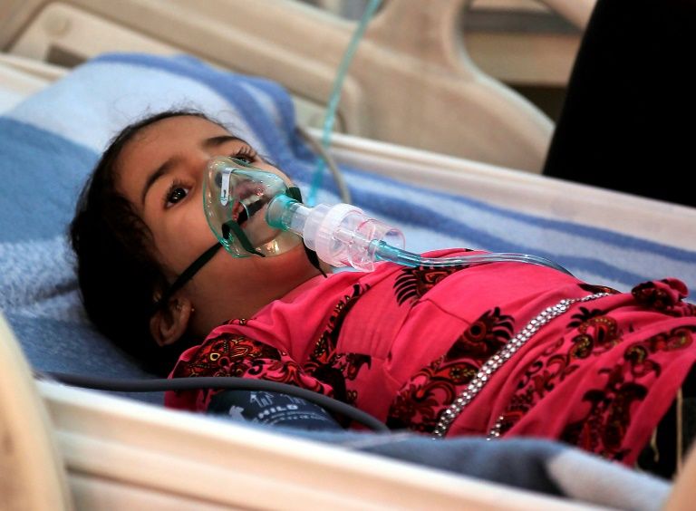 a yemeni child suffering from diphtheria receives treatment at a hospital in the capital sanaa photo afp