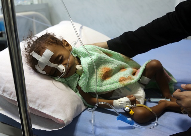 a malnourished yemeni child receives treatment at a hospital in the yemeni port city of hodeidah on november 21 2017 photo afp