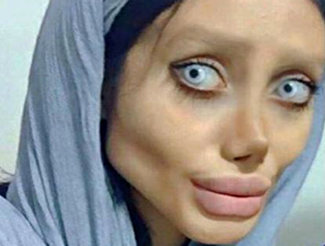 teenager goes too far in her obsession to look like angelina jolie