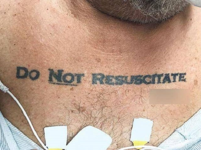 a 70 year old patient with a do not resuscitate tattoo left doctors stumped at miami university hospital photo nemj a 70 year old patient with a do not resuscitate tattoo left doctors stumped at miami university hospital photo nemj