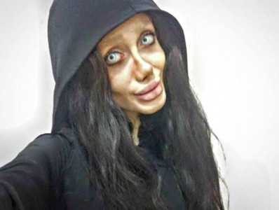 iranian teenager comes clean about her surgeries to look like angelina jolie iranian teenager comes clean about her surgeries to look like angelina jolie