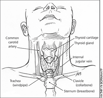 prof umer farooq pointed out that the thyroid condition is the second most common hormonal disorder in pakistan after diabetes photo afp