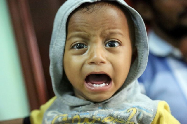 a yemeni child suspected of being infected with cholera cries at a hospital in the coastal city of hodeida photo afp a yemeni child suspected of being infected with cholera cries at a hospital in the coastal city of hodeida photo afp