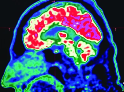 do microplastics mess up our minds