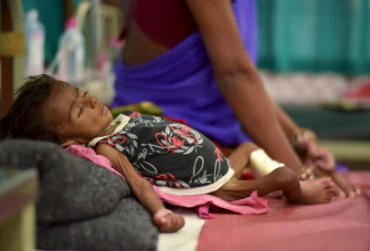 100 in indonesia s papua feared dead from malnutrition measles