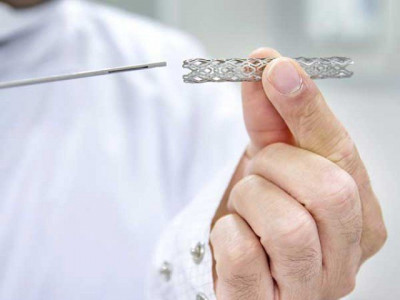 cost of heart stent reduced from rs0 3 million to rs0 1 million doctors tell sc cost of heart stent reduced from rs0 3 million to rs0 1 million doctors tell sc