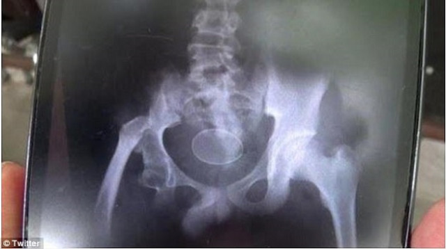 teenage boy claims to have laid 20 eggs from his rectum photo daily mail teenage boy claims to have laid 20 eggs from his rectum photo daily mail