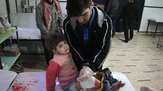 a wounded syrian girl receives treatment at a makeshift hospital following reported air strikes on the rebel held besieged town of douma in eastern ghouta photo afp