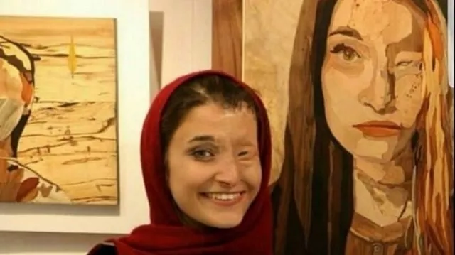 massoumeh attaie does not want to be defined only by the evil that drove her father in law to blind her with acid in her face she wants to be known as an artist photo courtesy fars news agency massoumeh attaie does not want to be defined only by the evil that drove her father in law to blind her with acid in her face she wants to be known as an artist photo courtesy fars news agency