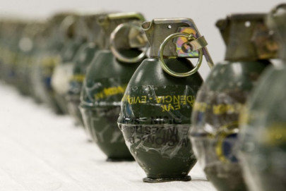 woman hands amputated after toy bomb explosion in north waziristan agency woman hands amputated after toy bomb explosion in north waziristan agency