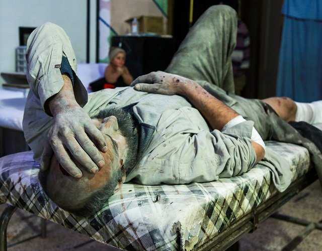 an injured syrian man covered in dust lies on a bed awaiting medical attention at a makeshift hospital in the rebel held town of douma in the besieged eastern ghouta region on the outskirts of the capital damascus following reported regime bombardment on march 3 2018 photo afp