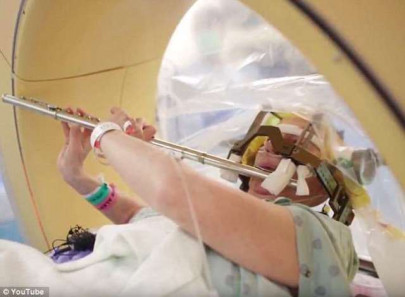 woman plays flute during open brain surgery woman plays flute during open brain surgery