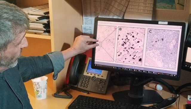 pathologist neil theise looks at medical slides in new york city photo reuters pathologist neil theise looks at medical slides in new york city photo reuters