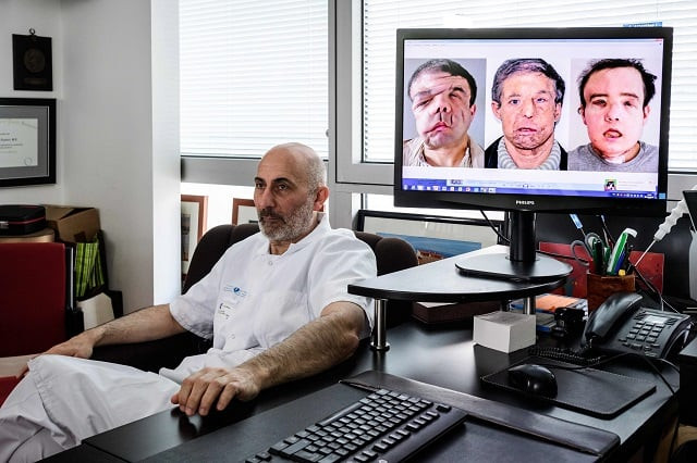 hamon suffers from a genetic mutation which causes severely disfiguring tumours and related complications photo afp hamon suffers from a genetic mutation which causes severely disfiguring tumours and related complications photo afp