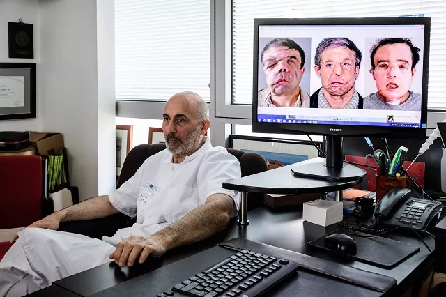 hamon suffers from a genetic mutation which causes severely disfiguring tumours and related complications photo afp hamon suffers from a genetic mutation which causes severely disfiguring tumours and related complications photo afp