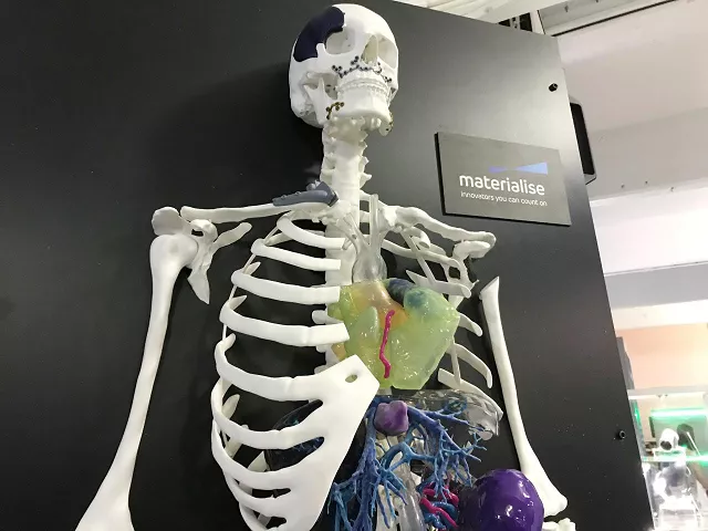 a sample 3d printed organs are seen on a 3d printed skeleton at an event hosted by general electric in new york ny us may 3 2018 photo reuters a sample 3d printed organs are seen on a 3d printed skeleton at an event hosted by general electric in new york ny us may 3 2018 photo reuters