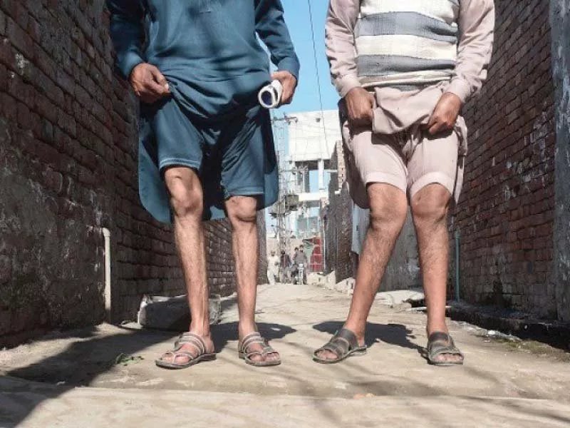 two residents show their deformed legs photo afp two residents show their deformed legs photo afp