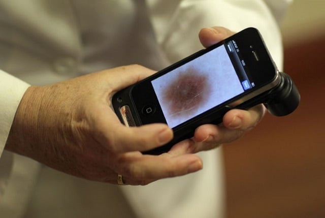 a computer was better than human dermatologists at detecting skin cancer in a study that pitted human against machine in the quest for better faster diagnostics researchers said tuesday photo afp a computer was better than human dermatologists at detecting skin cancer in a study that pitted human against machine in the quest for better faster diagnostics researchers said tuesday photo afp