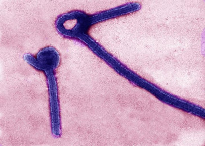 another case of congo virus reported in city