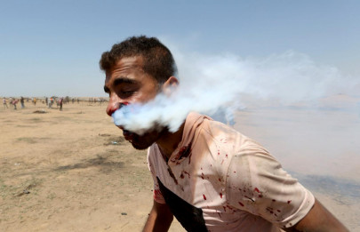 tear gas canister puts gazan on life support