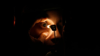 rainy season eye infections on the rise rainy season eye infections on the rise