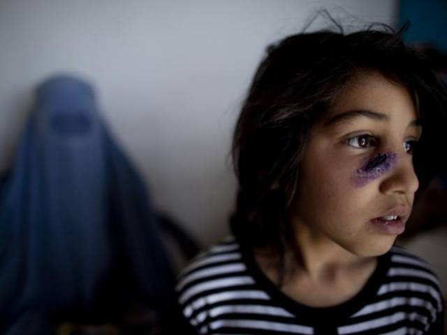 the report told the chief minister that most of the cases from k p were that of coetaneous leishmaniasis photo afp the report told the chief minister that most of the cases from k p were that of coetaneous leishmaniasis photo afp